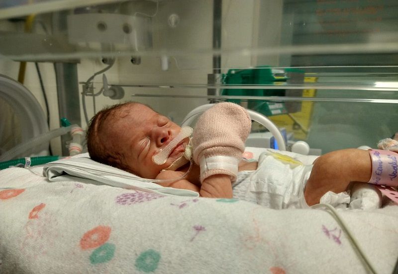 Prematura, a pequena Isabella precisou ficar internada na Utin (Foto: Acervo Pessoal)