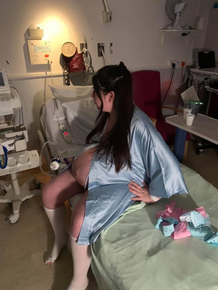 Os médicos da inglesa Amber Cumberland, 21 anos, acreditavam que ela estava grávida de gêmeos (Foto: Reprodução/ Facebook)