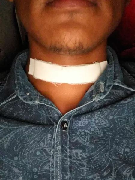 Jovem teve seu pescoço ferido (Foto: Acervo Pessoal)