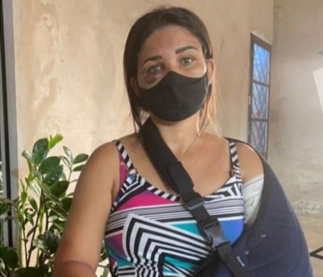 Adriana Araújo da Silva, de 38 anos, foi agredida por cliente de padaria. (Foto: Reprodução/TV tem)