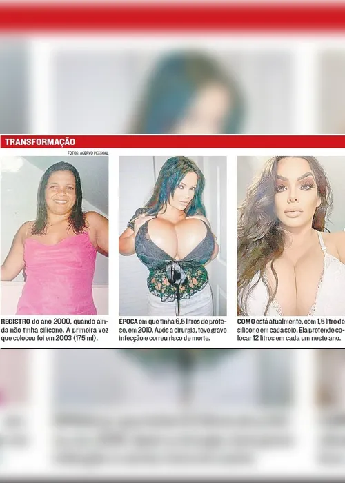 
          Imagem ilustrativa da imagem Capixaba quer ter os maiores seios do mundo
          