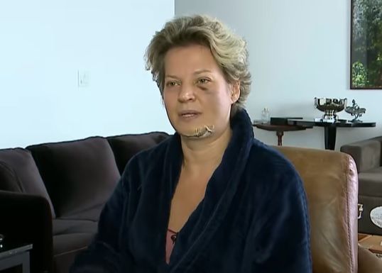 Joice Hasselmann apresenta 5 fraturas no rosto, diz não saber o que houve e aciona Polícia Legislativa (Foto: Reprodução/Youtube)