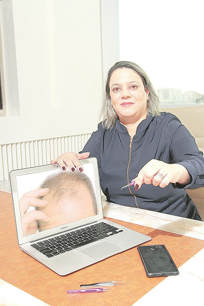 A médica Letícia Rizzo destaca técnica moderna de transplante capilar (Foto: Beto Morais/AT)