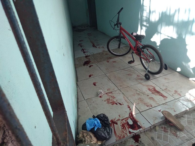 Jovem de 22 anos sofreu 11 perfurações de tiro. (Foto: Fábio Nunes/AT)