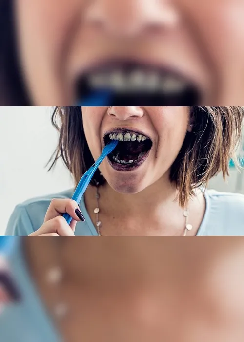 Imagem ilustrativa da imagem Médicos apontam as loucuras de beleza mais perigosas à saúde