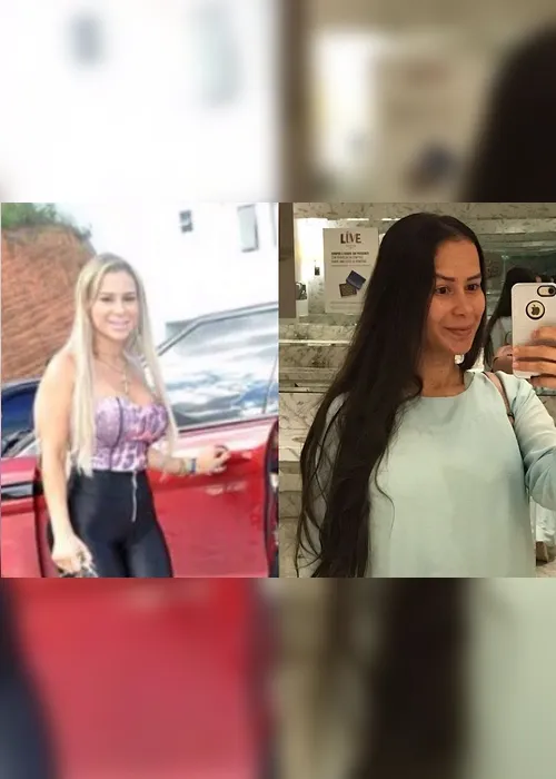 Imagem ilustrativa da imagem Ex-garota de programa pede ajuda para tirar silicone