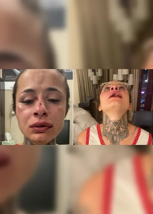 Imagem ilustrativa da imagem Tatuadora capixaba é espancada pelo namorado nos EUA pede ajuda na internet