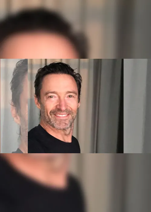 Imagem ilustrativa da imagem Com suspeita de câncer, Hugh Jackman fala sobre resultado de biópsia