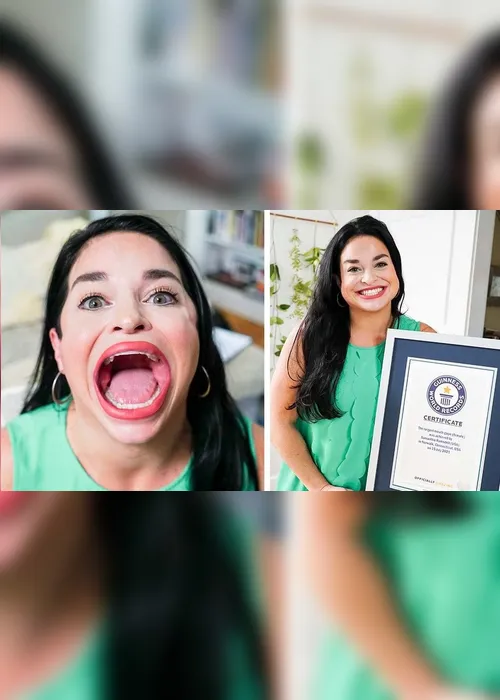 Imagem ilustrativa da imagem Mulher bate recorde com a maior boca do mundo