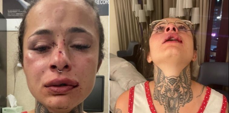 Tatuadora capixaba pede ajuda na internet após ser agredida (Foto: Reprodução/Instagram)