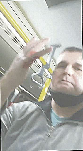 Júlio Dáuster teve a mão ferida (Foto: Reprodução de vídeo)