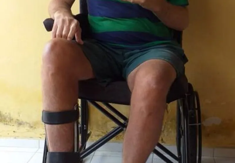 Ninão, como o paraibano é conhecido, deixou de andar e passou a conviver com dor há quatro anos e meio, quando foi diagnosticado com osteomielite.