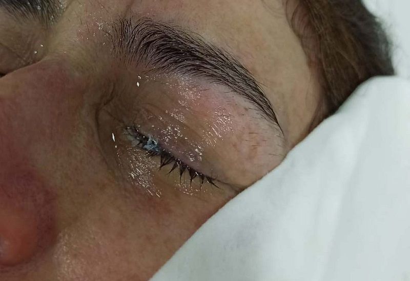 A mulher só percebeu o engano no momento em que pingou o produto no olho (Foto: Acervo pessoal)