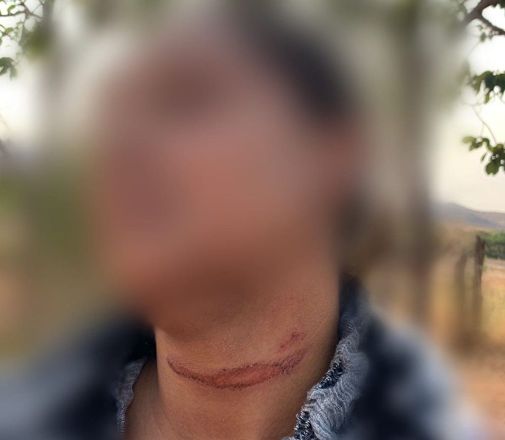 Ferimento no pescoço da esposa do vereador (Foto: Arquivo Pessoal)