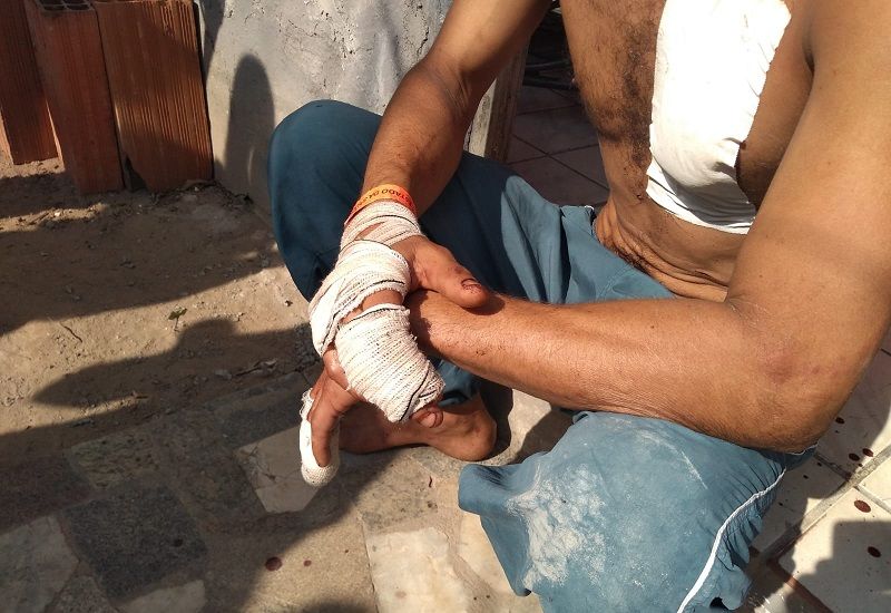 A vítima foi atacada enquanto contava a família que o padrasto estava fazendo empréstimos, ao invés de ajudar em casa (Foto: Júlia Afonso)