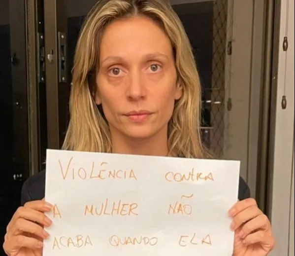 Imagem ilustrativa da imagem Luisa Mell denuncia ex-marido e diz que violência não acabou quando saiu de casa